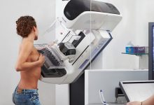 Pentru ce se face o mamografie?